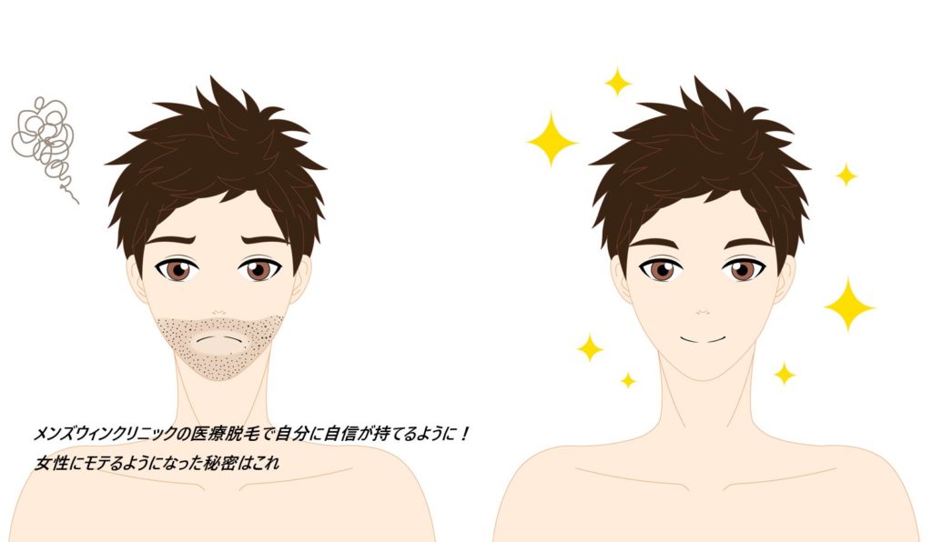 メンズウィンクリニックの医療脱毛が選ばれる理由は？実際に利用している男性の口コミ、評判も紹介【最新機器でコスパ/タイパ最高】
